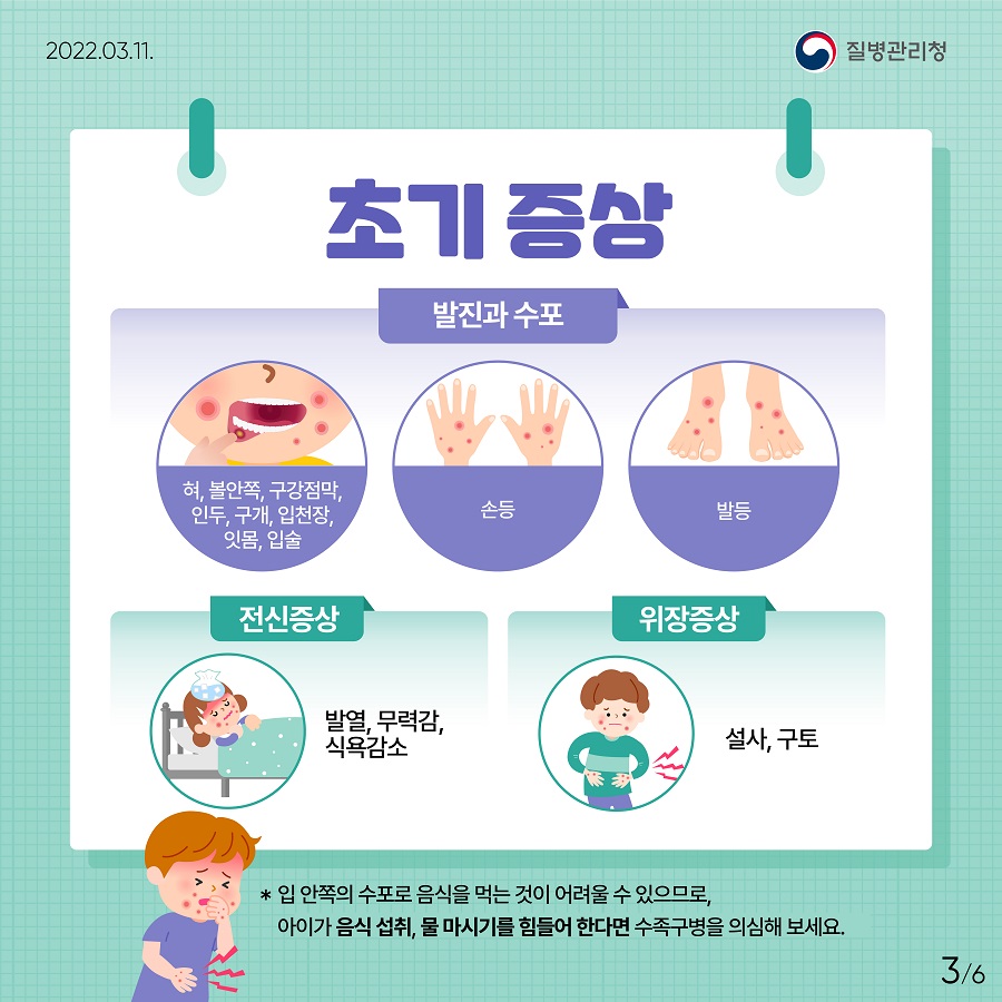 2022년 3월 11일, 질병관리청, 6페이지 중 3페이지, 초기증상, (발진과 수포) 혀, 복안쪽, 구강점막, 인두, 구개, 입천장, 잇몸, 입술, 손등, 발등 (전신증상) 발열, 무력감, 식욕감소, (위장증상) 설사, 구토, *입 안쪽의 수포로 음식을 먹는 것이 어려울 수 있으므로, 아이가 음식 섭취, 물 마시기를 힘들어 한다면 수족구병을 의심해보세요.